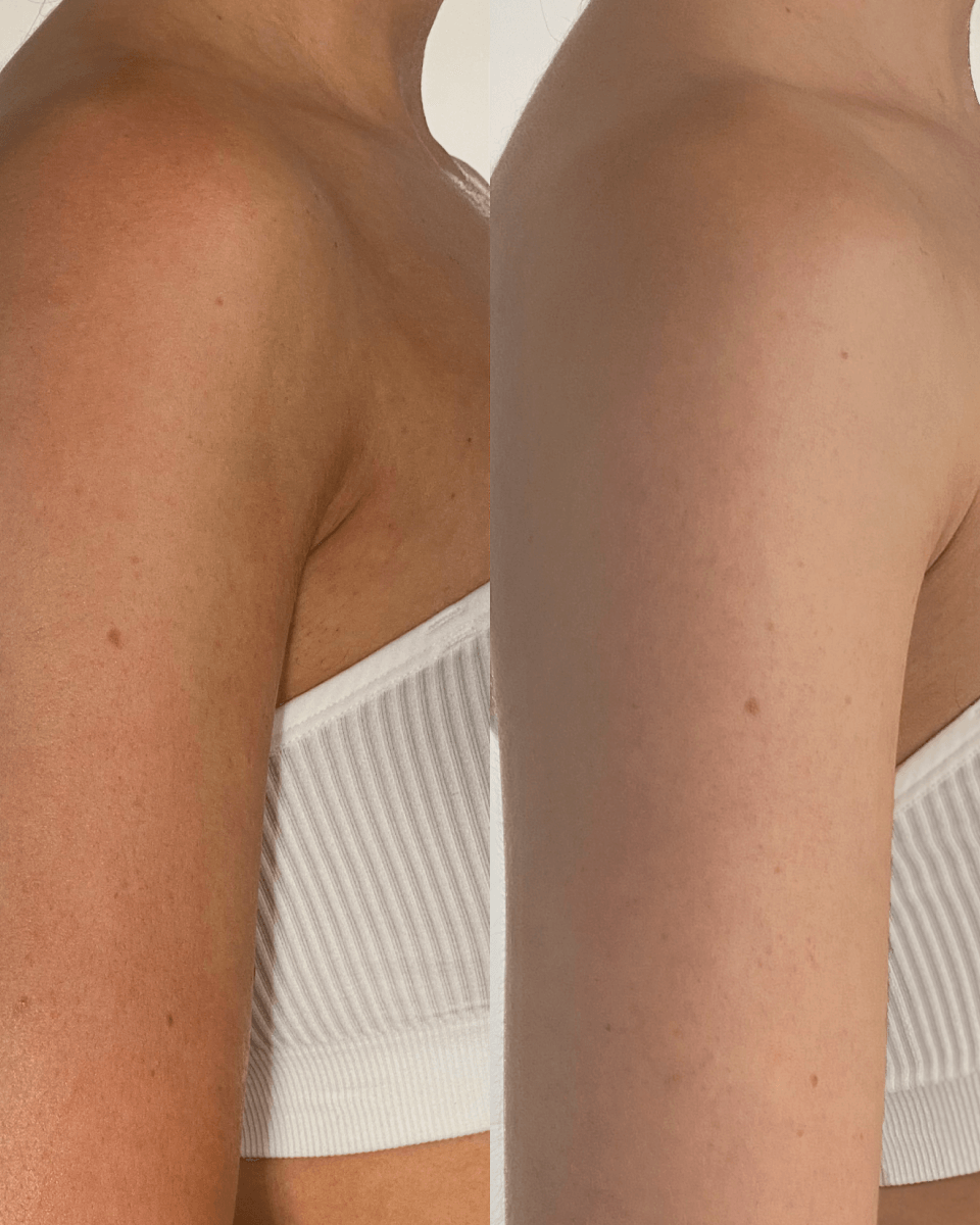 Deluxe Tan Remover
